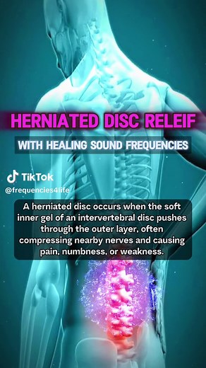 Herniated Disc Relief with Healing Sound Frequencies how to heal a herniated disc naturally signs of a herniated disc how to heal herniated disc lower back how to cure herniated disc herniated disc healing timeline how to relieve herniated disc pain #fypシ #viral #herniateddisc #hernia #backpain #soundhealing #rifefrequencies