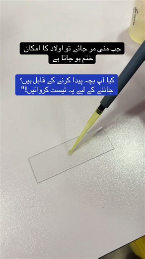 Understanding Semen Analysis for Fertility Testing