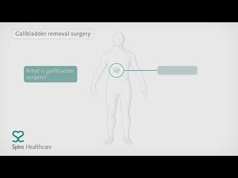 Keyhole surgery for gallbladder removal | Spire Healthcare