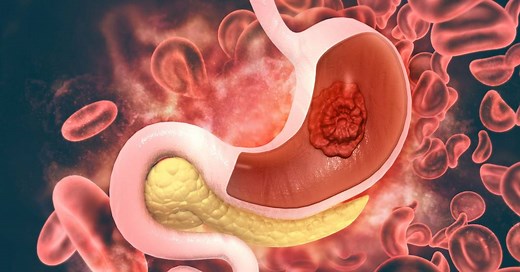 Veja e baixe um mapa mental do Sistema Digestório