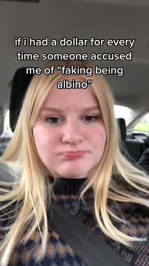 Debunking False Albino Accusations - Lizzie's Story