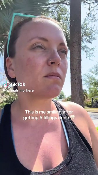 Numbness After Dental Fillings: My Experience