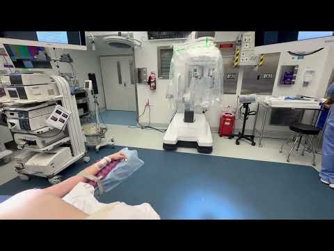 Optimal Positioning for an SP single incision robotic subxiphoid thymectomy