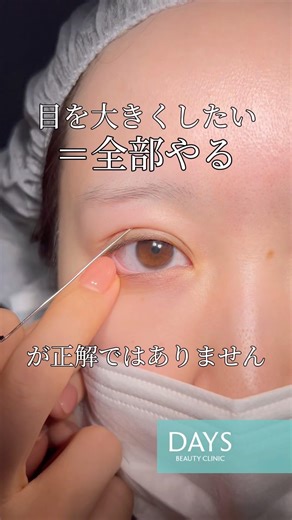 【目元整形】目を大きくしたい＝全部やるが正解ではありません#shorts