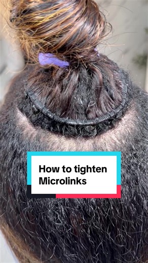 Weft Microlink Tightening Schedule: 4–6 Weeks Guide