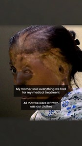 10K reactions · 363 shares | Support Shaheen's mission to provide care and hope to acid attack survivors. Donate here: https://give.do/fundraisers/join-shaheen-in-the-fight-against-acid-attacks-donate-now?utm_source=meta_pt&utm_medium=cpc&utm_campaign=66de769e41b45b59ca4108ec | Give | Facebook