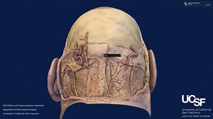 Model 2. Superficial Layer - Posterior Muscles.mov