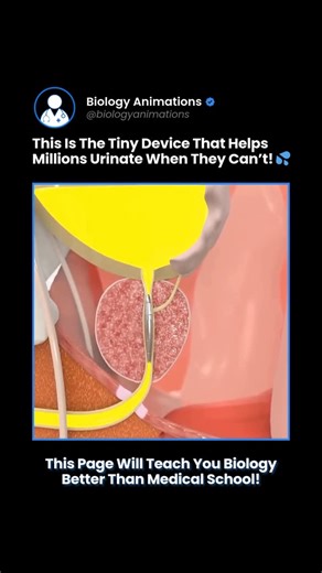 Biology • Science • Medicine | Here’s what’s actually happening 👇 This 3D medical animation illustrates the urinary catheterization procedure, a common clinical... | Instagram