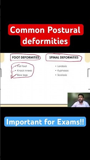 Common Postural Deformities Explained | Physical Education by Rahul Sir | NET | EMRS | UP LT | PTI