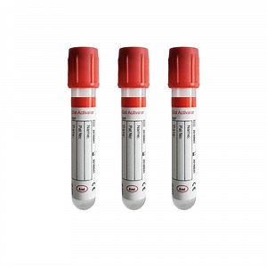 [Hot Item] Disposable Test Tube Blood Collection Tube Glucose Tube