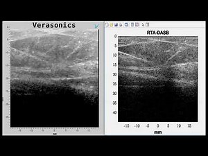 Reflection Tuned Apodization - Experiments with Beef Tissue with Femur Bone and Needle