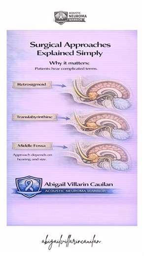 Abigail Villarin Cauilan on Instagram: "🧠 Surgical Approaches Explained Simply If you’ve been diagnosed with an acoustic neuroma, you may hear complicated terms like: • Retrosigmoid • Translabyrinthine • Middle Fossa It can feel overwhelming. Let’s simplify it 👇 🔹 Retrosigmoid Approach Done through an opening behind the ear. Often used for medium to large tumors. May offer a chance at hearing preservation in some cases. 🔹 Translabyrinthine Approach Done through the inner ear. Used when heari