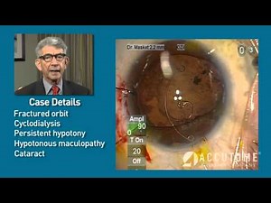 Applications of the Ultrasound Biomicroscopy