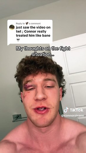 Connor Sinann's 3v1 Fight: Unveiling Nightlife's Dark Side