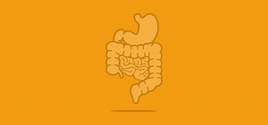 Ascitic tap (paracentesis) - Oxford Medical Education