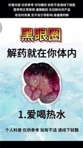 去除黑眼圈，其实很简单！#每天跟我涨知识#淡黑眼圈#黑眼圈#黑眼圈是怎么来的