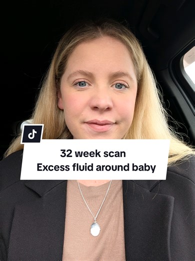 Navigating Polyhydramnios at 32 Weeks Pregnant