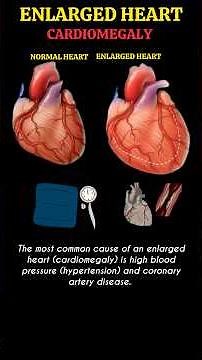 What Causes Heart To Enlarged - Cardiomegaly #heartdisease #cardiomyopathy