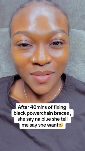 Fashionbraces on TikTok