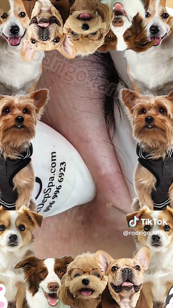 Cyst Popping Techniques: Tips for Skin Care Enthusiasts