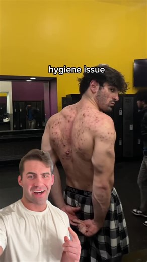 Garrett Holt | Med Student | Wholistic Health on Instagram: "This isn’t a hygiene issue. High androgen levels increase sebaceous gland activity, driving excess sebum production, clogged pores, bacterial overgrowth, and inflammation. The same mechanism applies whether those androgens are rising naturally during puberty or coming from exogenous hormones. Genetics—especially DHT sensitivity—largely determine who develops severe acne and who doesn’t."