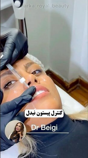 آموزش تزریق فیلر لب | Lip Fille Injection Training