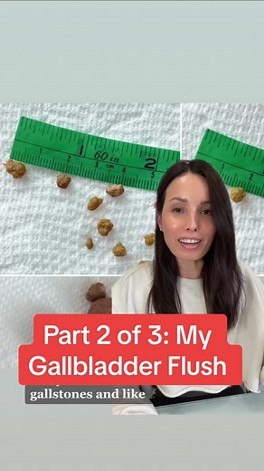 I did another gallbladder flush and I’m here to talk about it. This is NOT MEDICAL ADVICE. I am just sharing what I have personally done. #nutritionist #nutritionistsoftiktok #holisticnutritionist #gallbladder #gallstones #gallbladderflush #optimalhealth#greenscreen