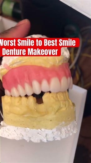 Worst Smile to Best Smile – Denture Makeover #dentures #dentist #denturesmile