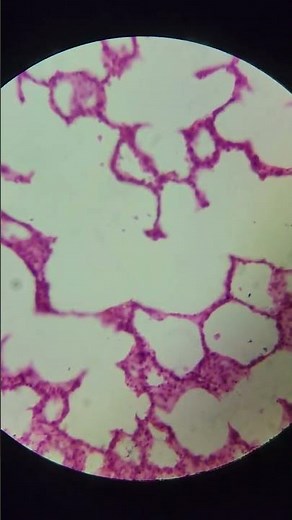 LUNGS at 40x,100x, 200x and 400x magnification | LUNGS under the miscroscope