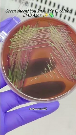 Streaking Success: Unlocking pure E.coli culture on EMB agar🧫🦠