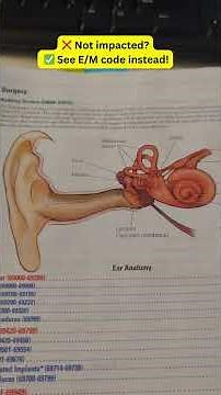 How to Code Ear Wax Removal (CPT 69209 vs 69210) #medicalcoder #cpt #codingtips