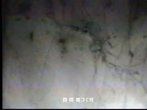 TEM study of dislocation moving in a ferritic steel, close up