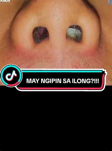 Discover the Secrets of Youthful Smiles with Corrective Dentistry