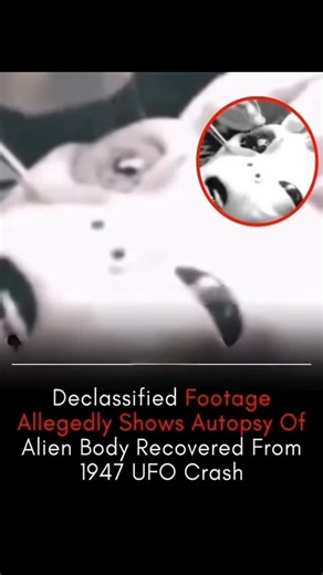 cosmicXplorel07 | 👽 Declassified Alien Autopsy Footage? The 1947 UFO Mystery Still Unsolved! 🛸 A controversial video claims to show the autopsy of an... | Instagram