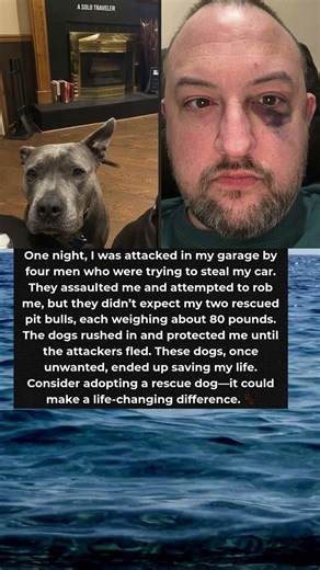 Nobody Wanted These Dogs… Then They Saved My Life 🐶❤️