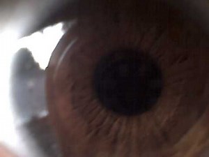 The Human Eye at 20x Zoom Under Microscope