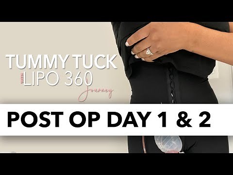 Lipo 360 with Tummy Tuck Pt 3 | Post Op Day 1 & 2