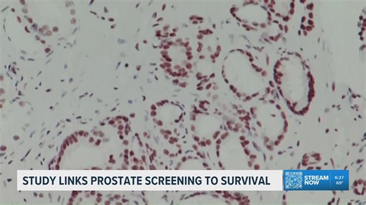 Blood test screening may improve early prostate cancer detection