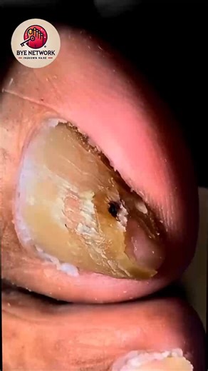 811. Best meditation apps to ease stress after fifty #MindfulLiving #HealthyAging #DigitalWellness | Bye