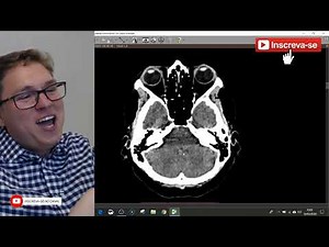 Avaliação Completa de uma Tomografia Computadorizada de Crânio