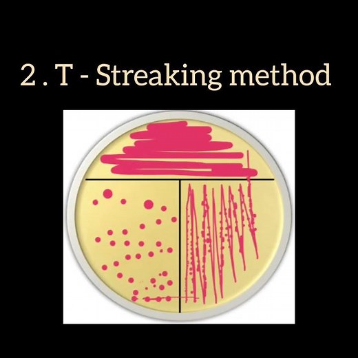 Types of streak plate method #knowledge of microbiology