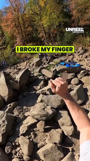 Not even a dislocated finger breaks the vibe 😳 | UNREEL