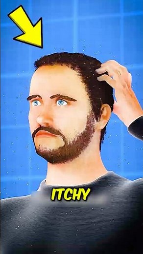 If You Ever Wonder What’s Crawling on Your Scalp, Watch This Immediately