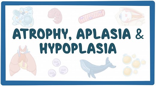 Atrophy, aplasia, and hypoplasia: Video, Causes, & Meaning | Osmosis