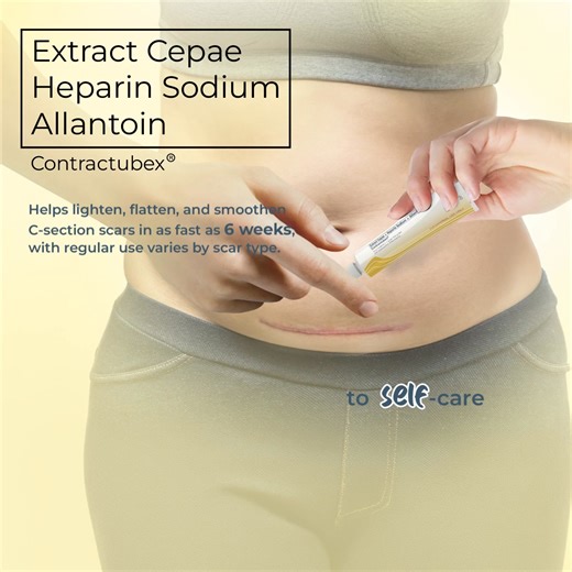 A C-section scar can make many women feel self-conscious but, with the proper self-care, they can get past that. Encourage them to make Extract Cepae Heparin Sodium Allantoin (Contractubex®) a part of their scar care routine to help lighten, flatten and smoothen scars in as fast as 6 weeks, with regular use, varies by scar type. #EveryHomeScarEssential #ScarsFadeConfidenceGained | Contractubex Philippines
