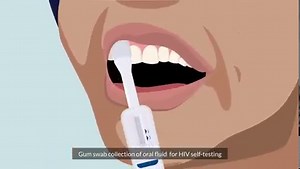 23K views · 160 reactions | How does OraQuick International HIV...