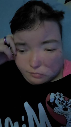 #ichzeigedirmeinlebenmitbehinderrung #derwichtigstemenschbleibstdu❤️franzie