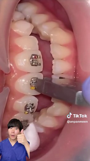 TikTokでまさ太郎(新米歯科医師)さんをチェック！