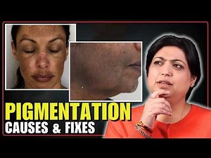 Facial Pigmentation Explained | Causes, Treatments, Melasma & Dark Spot Removal