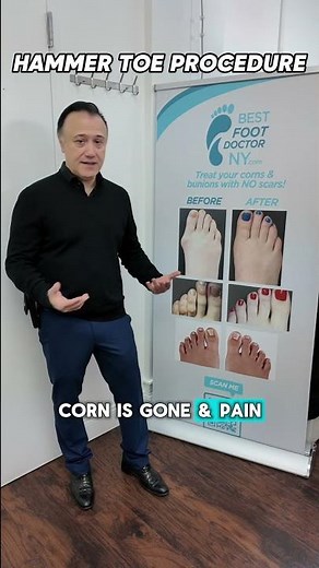 Ready to fix your hammer toe?